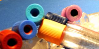 GLICEMIA! CHI ERA COSTEI?