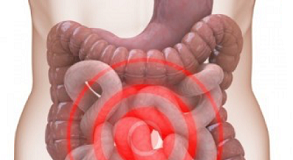 A PROPOSITO DI IRRITABILIT…SPUNTI ALIMENTARI